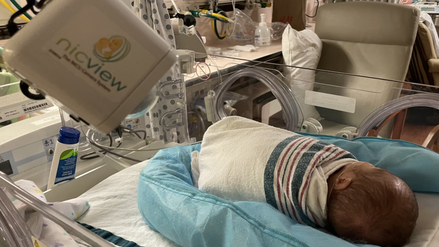 A NicView camera overlooking a baby in their NICU bed.