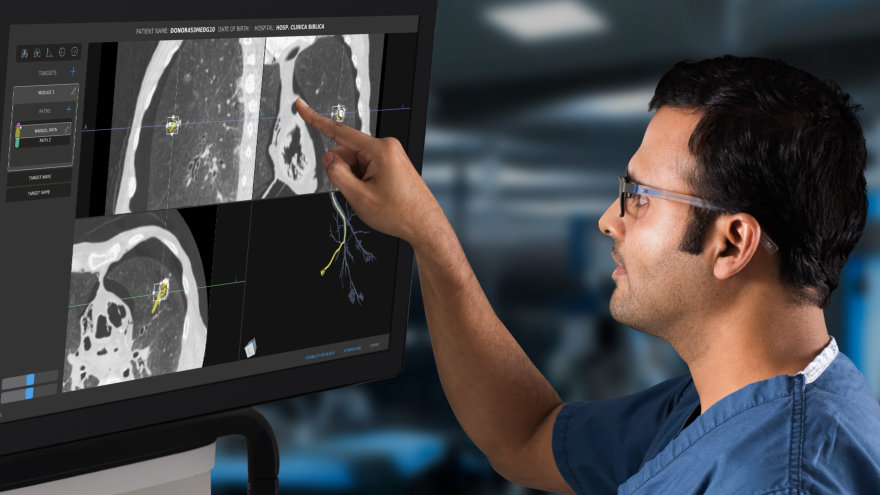 Doctor interacting with what he sees on the screen accompanying the MONARCH, Robotic-Assisted Bronchoscopy, platform.